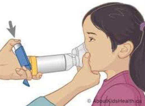 asthma 